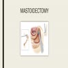 Mastoidectomy - Meddco - Picture Box