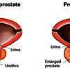 What is Gorilla Flow Prostate?