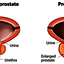 gorila-flow - What is Gorilla Flow Prostate?