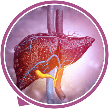 Kidney Transplant Surgeon in Hyderabad feronia