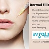 Dermal Filler Treatment in Bangalore