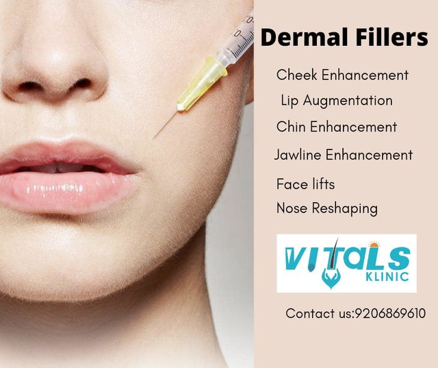 Dermal Filler Treatment in Bangalore - VitalsKlini Dermal Filler Treatment in Bangalore