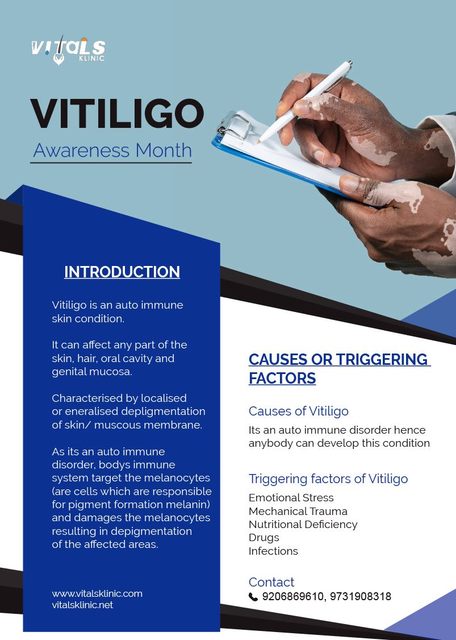 Vitiligo Treatment, White Patches Removal In Banga White Patches Removal In Bangalore