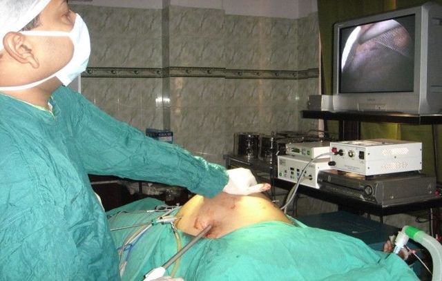 Dr R K Mishra - Laparoscopic Surgeon 48 Picture Box