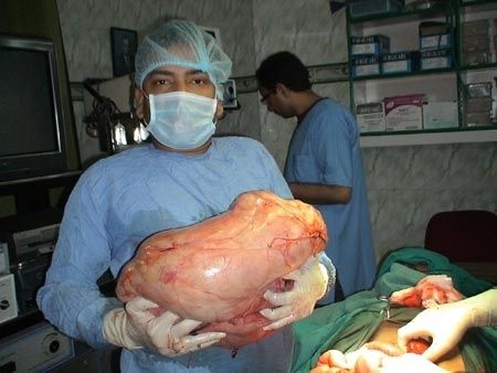 Dr R K Mishra - Laparoscopic Surgeon 61 Picture Box