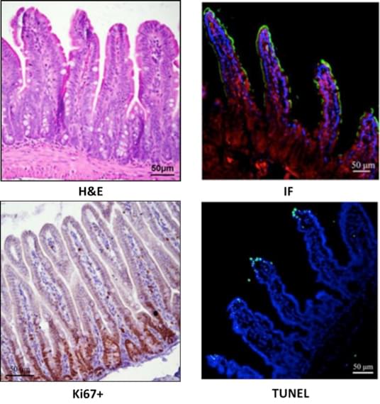 Immunohistochemistry bioarray