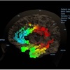 infra slow fluctuation neur... - online neurofeedback training