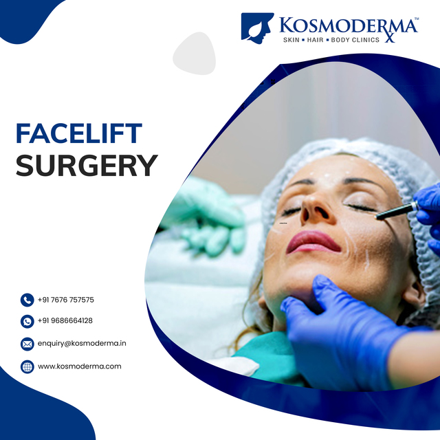 Kosmoderma Facelift Surgery in Bangalore Kosmoderma