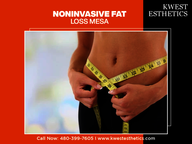 Noninvasive Fat Loss Mesa Noninvasive Fat Loss Mesa