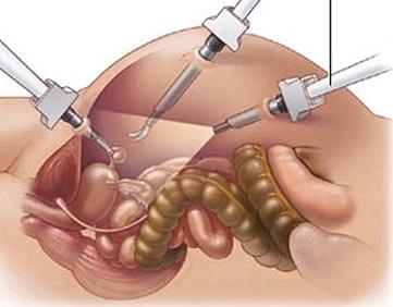 Best laparoscopic surgery doctor in Hyderabad â€“ Picture Box