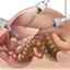 Best laparoscopic surgery d... - Picture Box