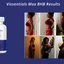 Max BHB Vissentials SCAM & ... - Max BHB Vissentials