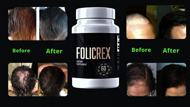 Folicrex | Reviews & Price Update Folicrex