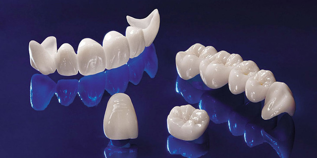 Dental Crowns and Bridges Picture Box