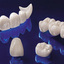 Dental Crowns and Bridges - Picture Box