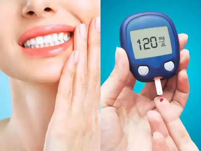 bien-chung-tieu-duong-o-rang (1) Bá»‡nh tiá»ƒu Ä‘Æ°á»ng