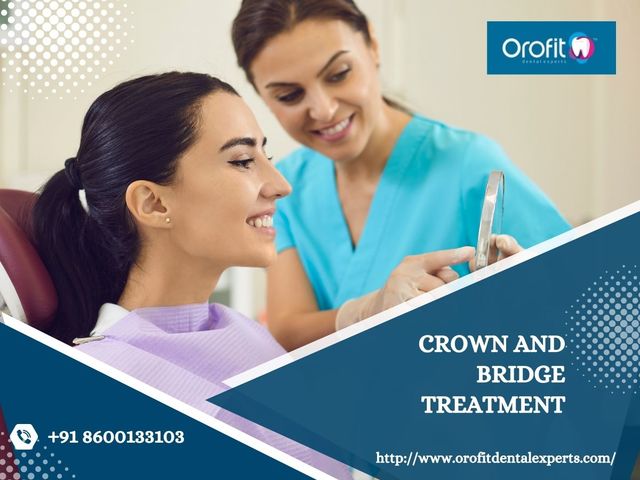 Get Excellent Crown & Bridge Treatment Picture Box