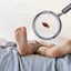 bed-bug-exterminator-spring... - Florida Bedbug Solutions - Tampa