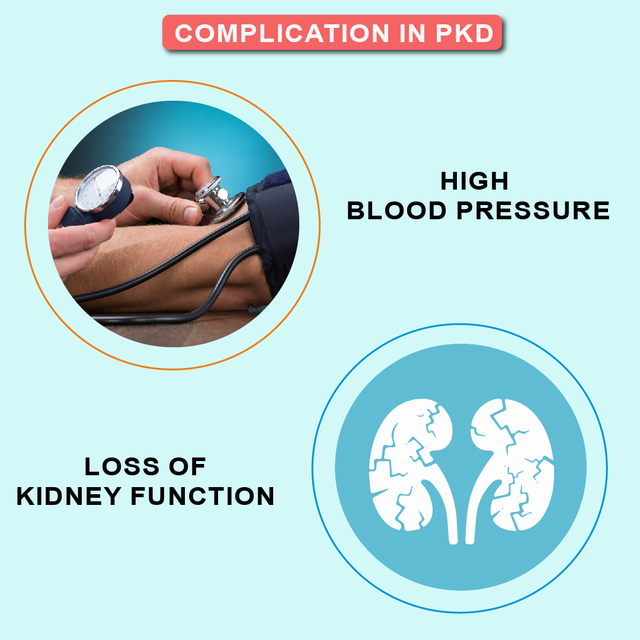 Complications in polycystic disease Picture Box