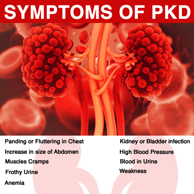Polycystic kidney Disease Polycystic kidney Disease