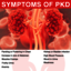 Polycystic kidney Disease - Polycystic kidney Disease
