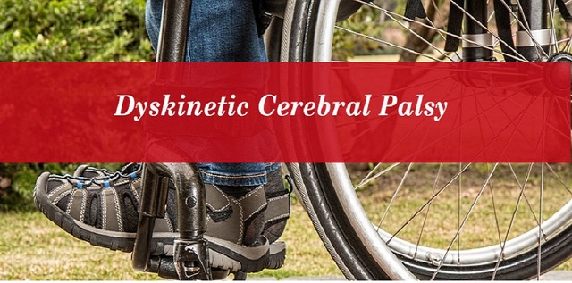 Diagnosing Dyskinetic Cerebral Palsy - Get the bes Trishla Foundation