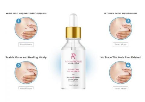 25106 preview Amarose Skin Tag Remover Reviews