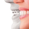 Dental Arch in Walled Lake - Dental Clinic in Walled Lake