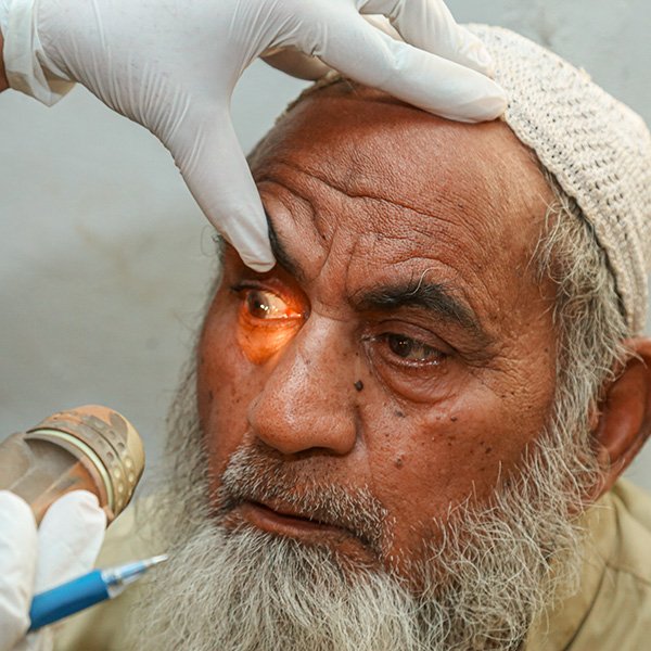 donate for eye checkup new