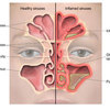 sinus - PLC pictures