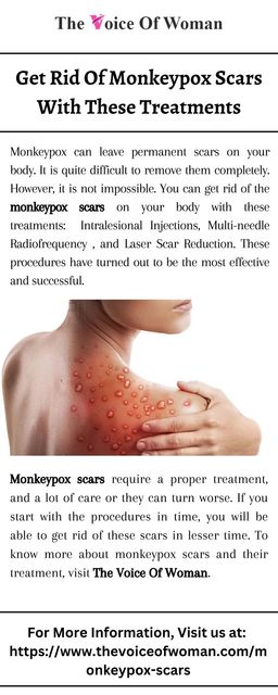 Get Rid Of Monkeypox Scars With These Treatments The Voice Of Woman