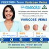 varicose veins