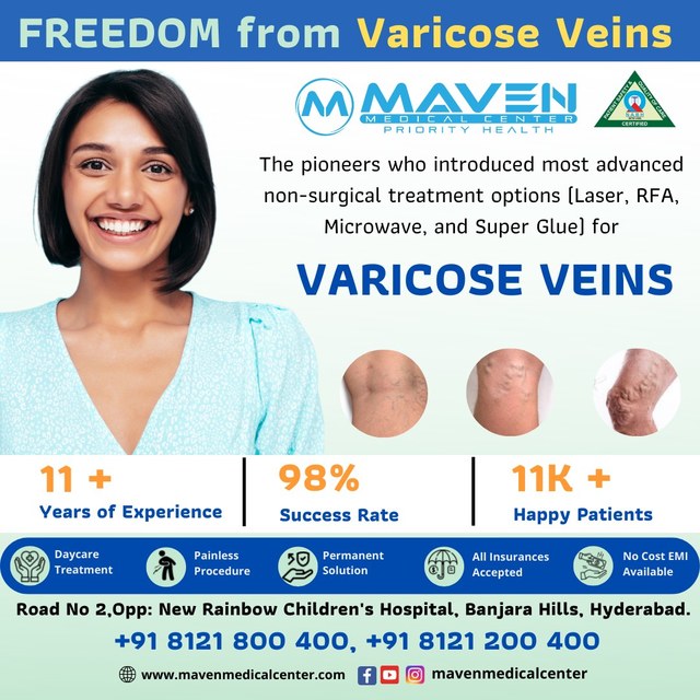 300999720 502086478587978 3063047511117902668 n varicose veins