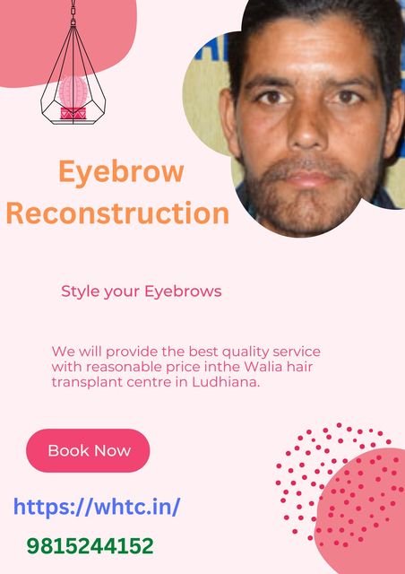 Cheapest hair transplant in Ludhiana Picture Box