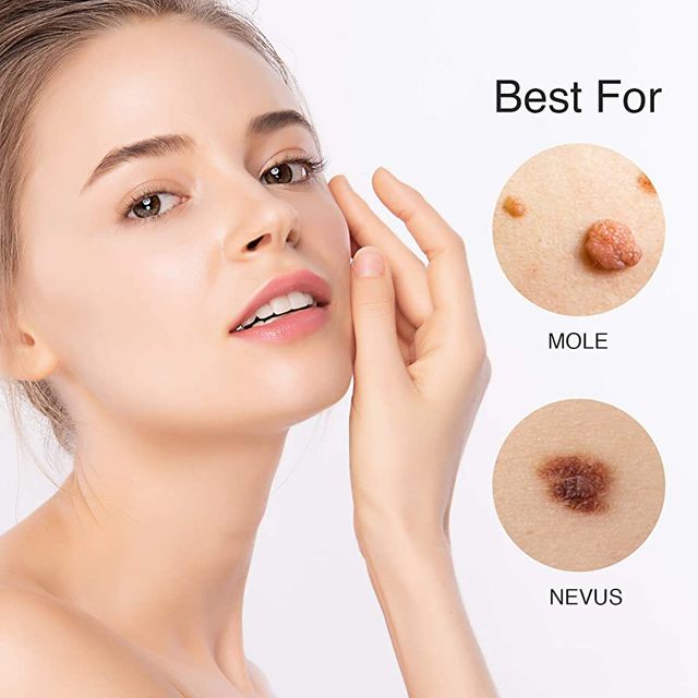 71MQG5jDcXL. AC UF894,1000 QL80  Paradise Skin Tag Remover