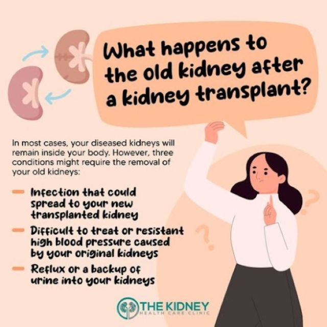 image 1 did you know your original kidneys are usually left in your body after kidney transplantation unless they are causing severe problems?