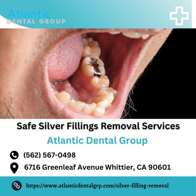 Silver Filling Removal Services Atlantic Dental Group