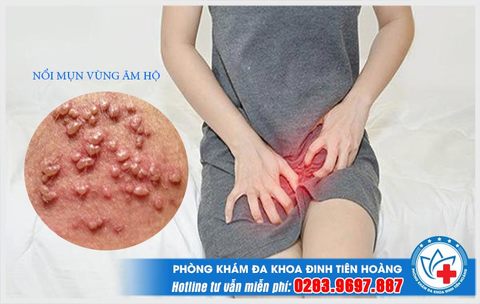 noi-mun-am-ho - Anonymous