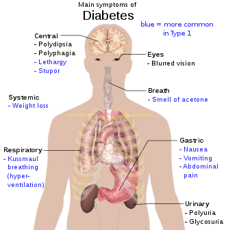 330px-Main symptoms of diabetes.svg gluco trust reviews