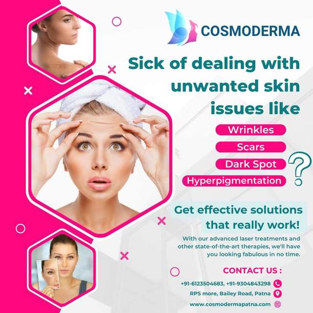 Best  Skin Care in Patna - Copy Cosmoderma patna