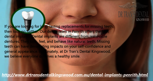 Dental Implants Penrith Picture Box