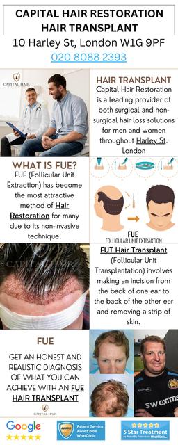 Best UK Hair Transplant Best UK Hair Transplant. Here at Capital Hair Restoration, Harley Street Clinic.