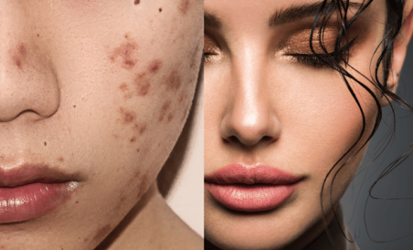 p2-1193164-1676895530 Deor Skin Tag Remover Reviews