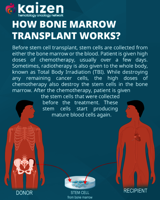 Bone Marrow Transplant in Hyderabad Bone Marrow Transplant in Hyderabad