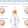 Amarose Skin Tag Remover