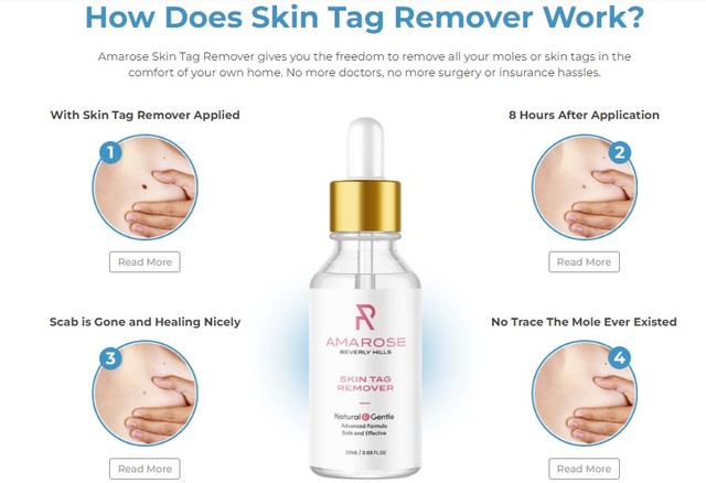 Amarose Skin Tag Remover How Amarose Skin Tag Remover