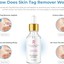 Amarose Skin Tag Remover How - Amarose Skin Tag Remover