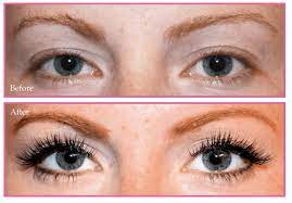 Discover the Benefits of Eyelash Extensions for Yo Picture Box