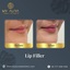 Beauty Clinic, Skin Care, L... - MY AURA AESTHETIC SKIN CLINIC (St. John Branch)