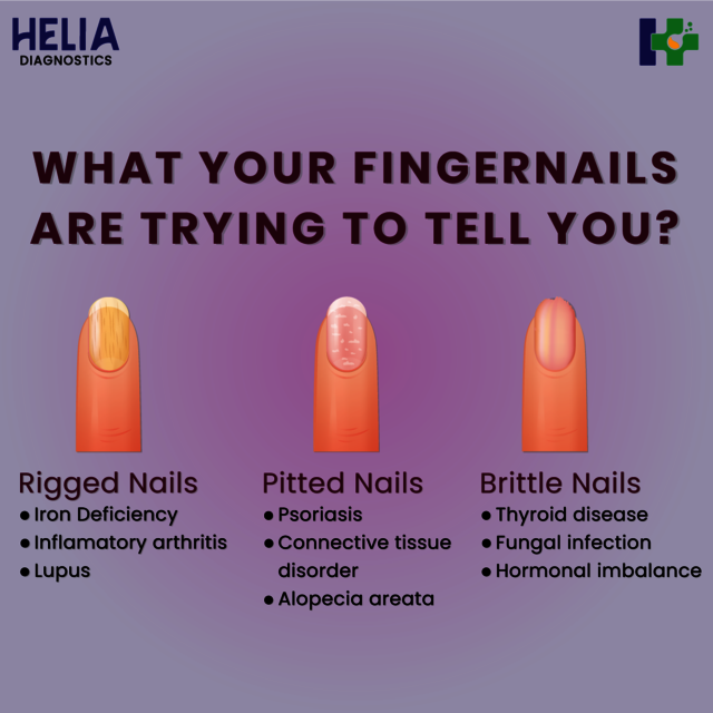 Fingernails how can i find best diagnostic center in Hyderabad